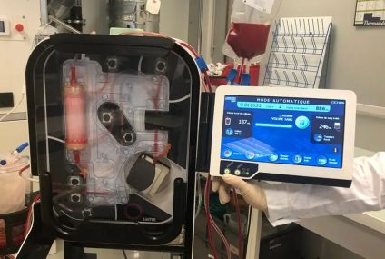 Une machine innovante pour transfuser un patient avec son propre sang arrive dans les hôpitaux