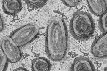 Des cas de variole du singe placent le Cameroun en état d’alerte