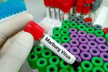 Maladie à virus de Marburg : aucun malade confirmé, mais 15 cas suspects prélevés au Cameroun