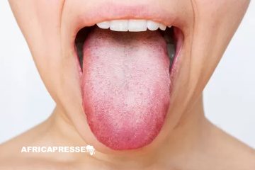 Rouge, jaune ou mauve: voici ce que votre langue peut révéler de votre santé