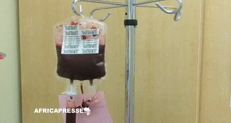 Transfusion sanguine : pourquoi l’Afrique peine à exploiter la découverte d’un nouveau groupe sanguin Transfusion sanguine