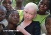 Madagascar : des attaques ciblant des albinos replongent le pays dans l’angoisse