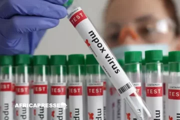 Mpox : l’OMS maintient l’alerte maximale face à la progression du virus en Afrique Mpox : l’OMS maintient l’alerte maximale face à la progression du virus en Afrique