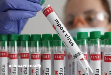 Mpox : l’OMS maintient l’alerte maximale face à la progression du virus en Afrique