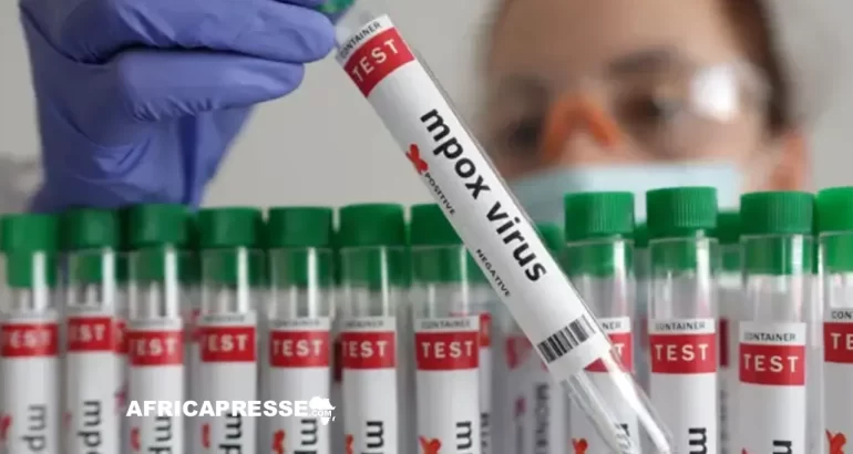 Mpox : l’OMS maintient l’alerte maximale face à la progression du virus en Afrique.