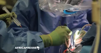 Cameroun : opération réussie pour retirer une tumeur cérébrale géante chez une adolescente