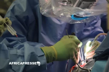 Cameroun : opération réussie pour retirer une tumeur cérébrale géante chez une adolescente