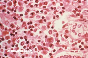Hantavirus : le CDC Afrique en état d’alerte après trois morts à bord d’un navire de croisière